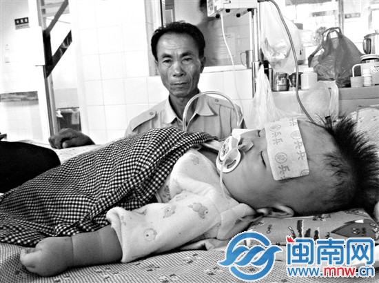 小孩因细菌感染，引发肠壁溃疡坏死穿孔
