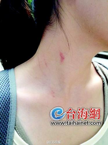 起因是揽客不成起争执 (1)