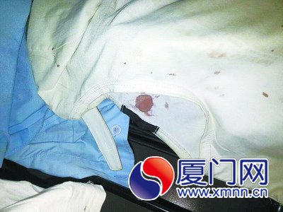 嫌疑人的衣服上沾着的哥的血