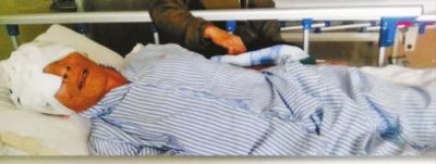 医院称病人黄超强眼球被挖系自残，但病人家属表示不 