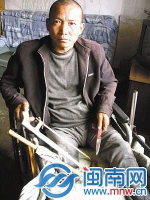 郑艳良用这几样简陋工具，给自己做了右腿截肢手术