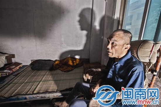 因为神经系统紊乱，王育斌经常抽搐脸部狰狞