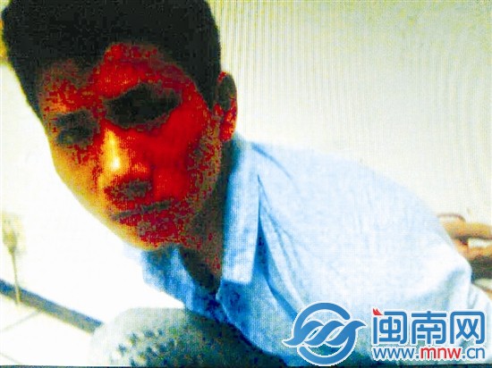 惊醒屋中人 小偷连捅男房客七刀