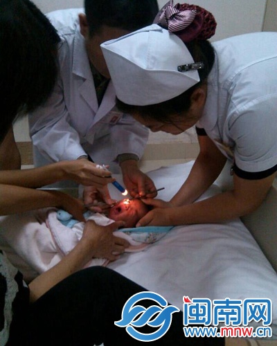 医生在帮宝宝检查眼睛