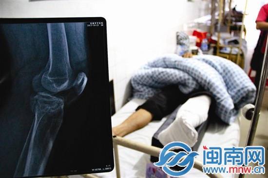 拍片显示，林再辉左腿左侧胫骨平台粉碎骨折