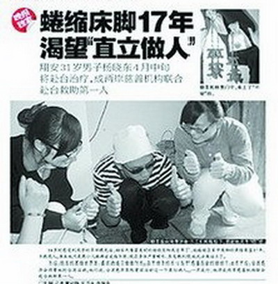 “蜷缩人”
