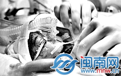 六百八十克袖珍婴儿