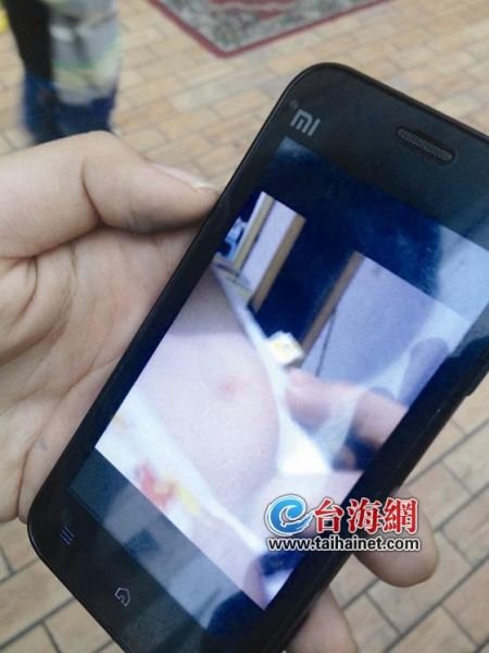 儿子疑幼儿园被伤