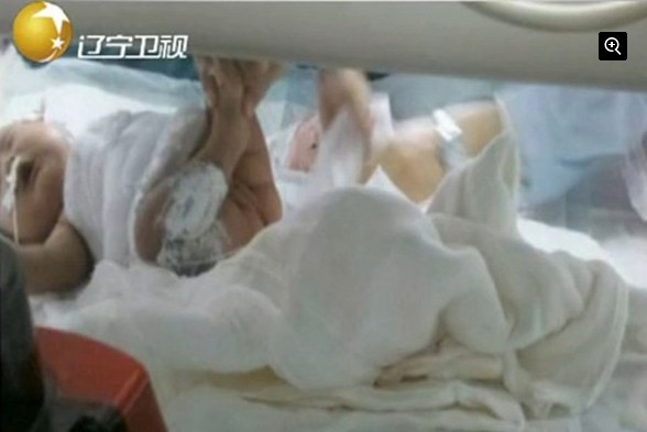 图为抢救中的女婴（视频截图）。