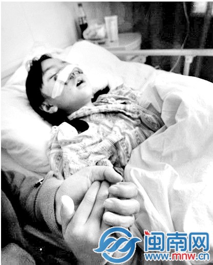 出事后的小英面目受伤严重