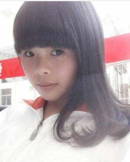 厦门17岁少女吃烤鱼被烧成火人