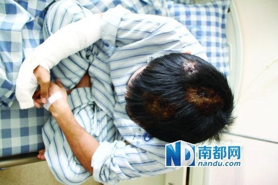 惨遭毒打的男子