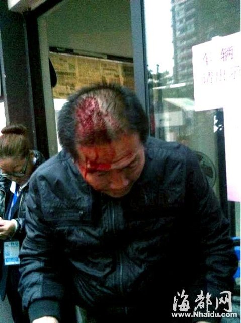 福州一小区40楼装修高空坠物 取车老伯被砸伤