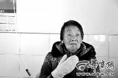 事发5日后，受伤的李群玲下巴处仍能看到被咬的伤痕 