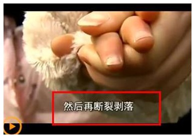 杭州儿童指甲断裂事件