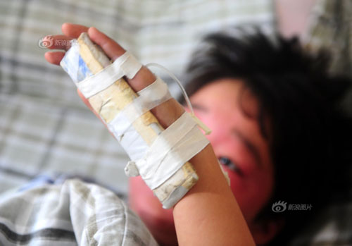 广州恶父毒打儿子致残后弃垃圾桶1