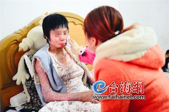 今非昔比，晓晓只能躺在出租房里养伤
