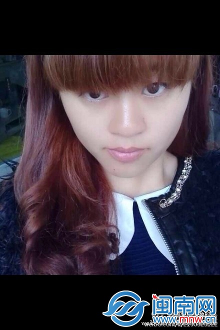 少女黄秋虹烧伤前照片