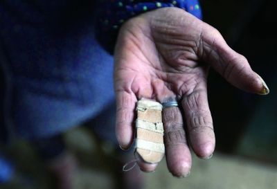 遭割耳男童婶婶被指做事极端