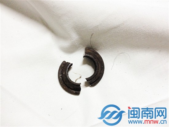 七旬大爷 下体被钢圈套住