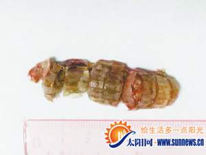 卡在小王喉咙的虾蛄