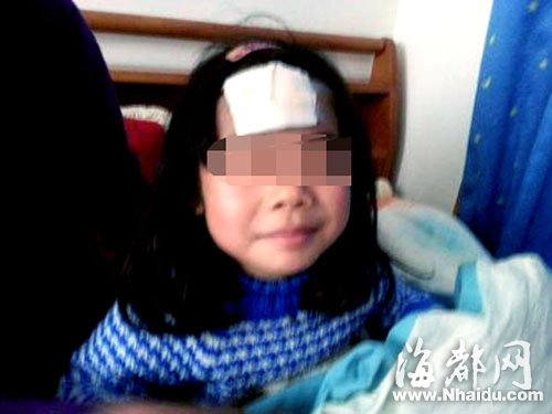 福州温泉公园喷泉旁 台阶角太利女童脸被割(图)