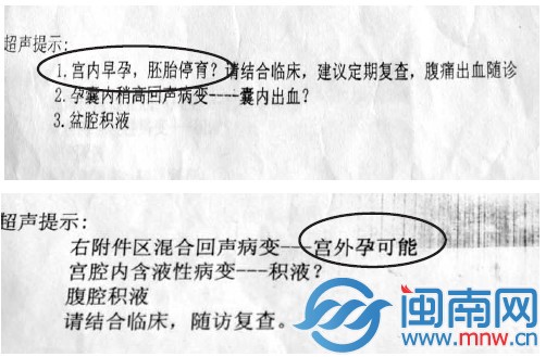 吴女士3天内两次B超检查，从宫内孕变宫外孕
