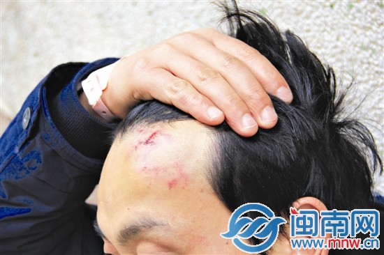 熊师傅头部被打伤