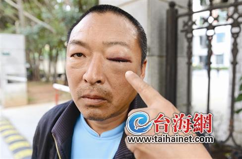 车主不听劝还打保安