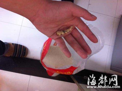 陈依伯吃出的假牙约5厘米长