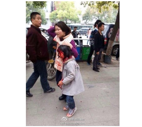 被砍伤的一名小孩