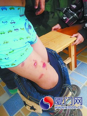 小毅被咬得遍体鳞伤