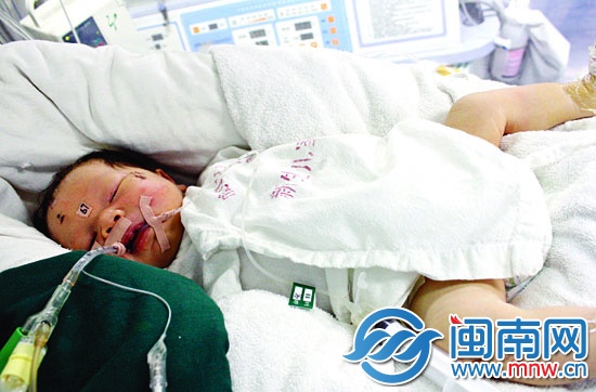 厦门奇迹宝宝赵平安病情加重