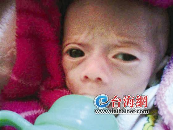 19岁高中女生诞下双胞胎女儿