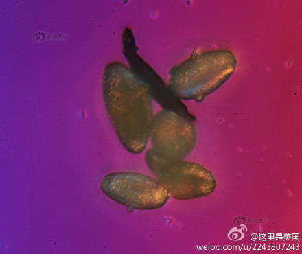 霾颗粒放大1000倍后2