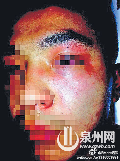 微博上被打学生的照片