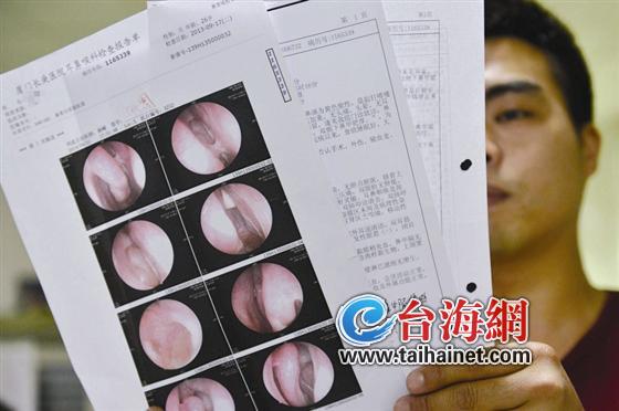 3年前林先生曾在长庚医院做过鼻窦炎手术