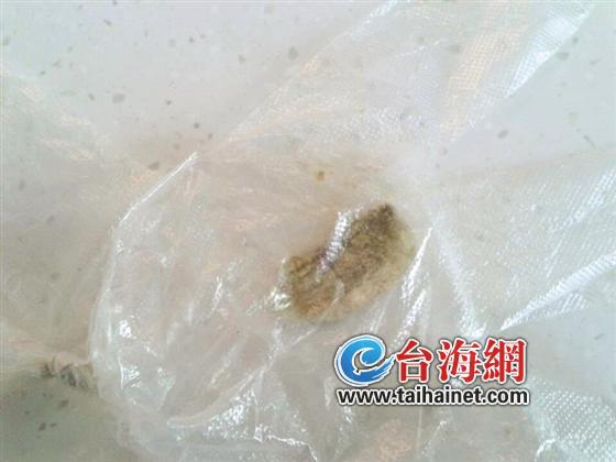 十几天前林先生打喷嚏喷出异物