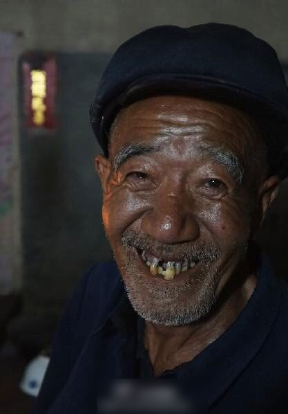 “挂面爷爷”因骨癌永远地离开了，享年67岁。