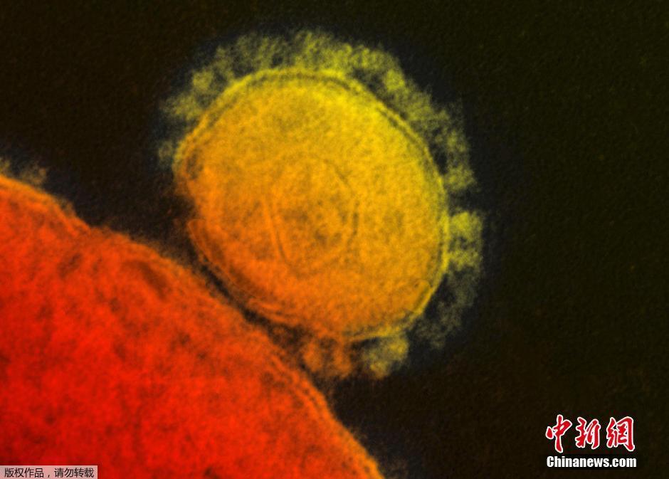 中东呼吸综合征(MERS)