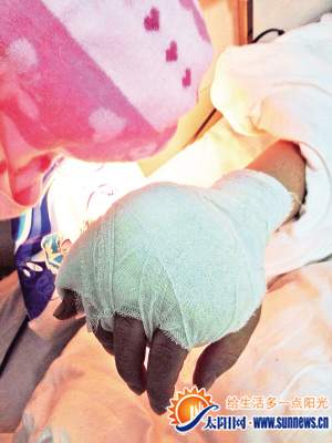 女子手指被砍断