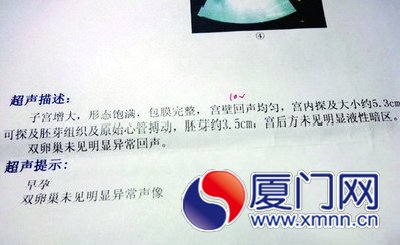 第三医院正确的检查报告
