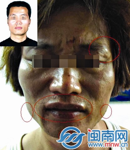 杀人后整成“猪哥亮” 逃亡20年1