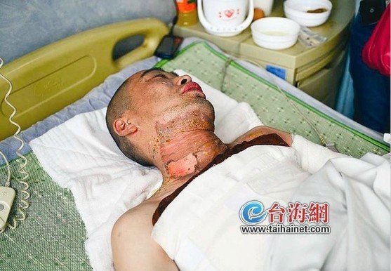 受伤求助无果竟点火自焚