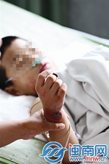 男孩爬电线杆抓鸟 睾丸被烧焦