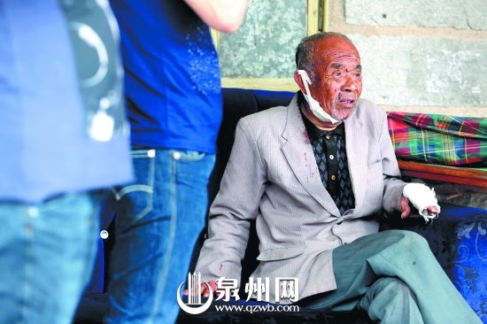 老人被玻璃碎片弄伤,头发也部分被烧。