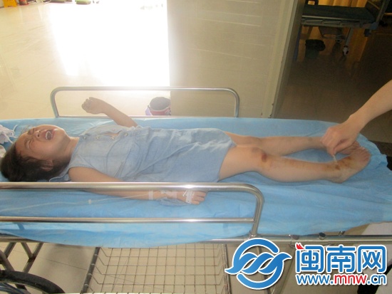 楼下的泡沫和破布起了缓冲，只是轻微擦伤