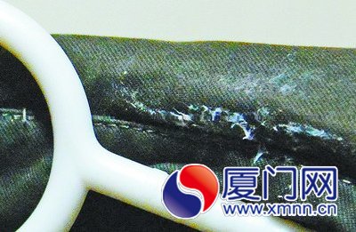 衣领发霉长出白毛
