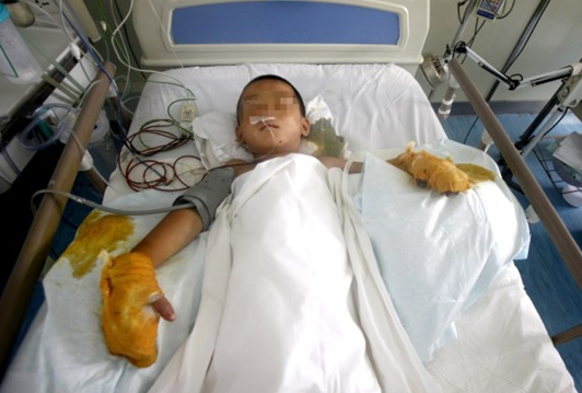 石家庄6岁男童遭继母捆绑吊打1