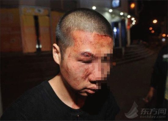 上海市民乘车遭老外无端殴打